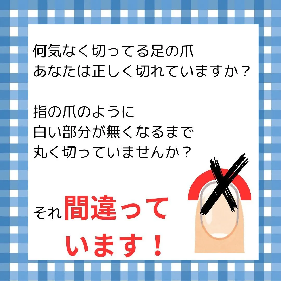 正しい足の爪の切り方！あなたは出来ていますか？