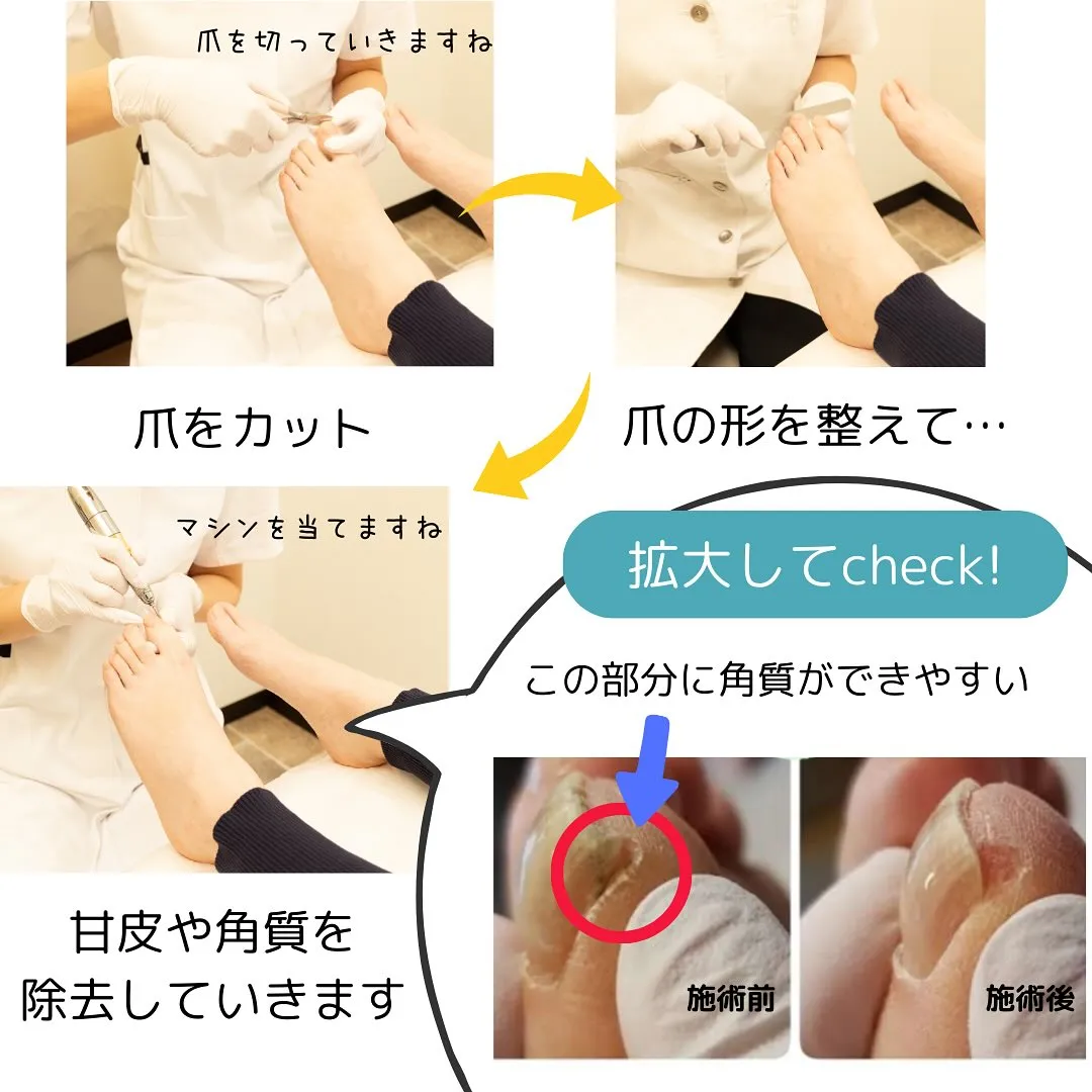 メニュー紹介🌟ネイルキュアコース