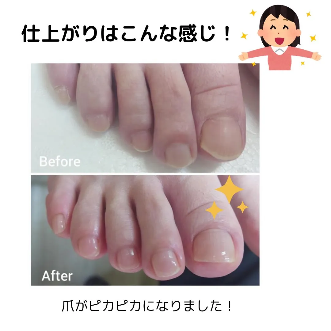 メニュー紹介🌟ネイルキュアコース