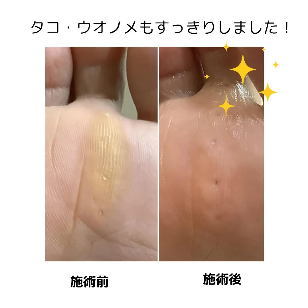 メニュー紹介🌟フットキュアコース