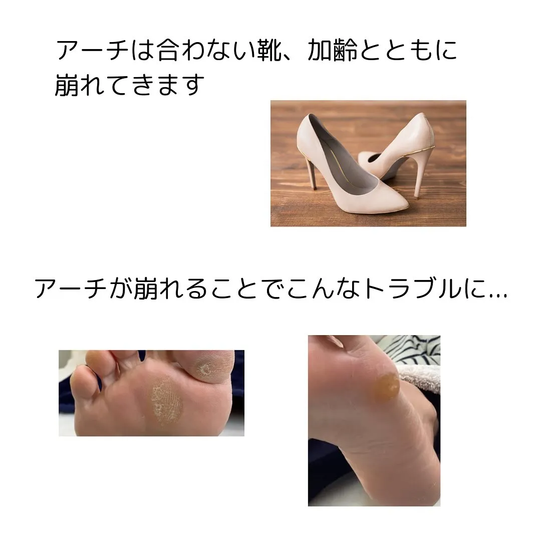 メニュー紹介🌟アーチケアトリートメント