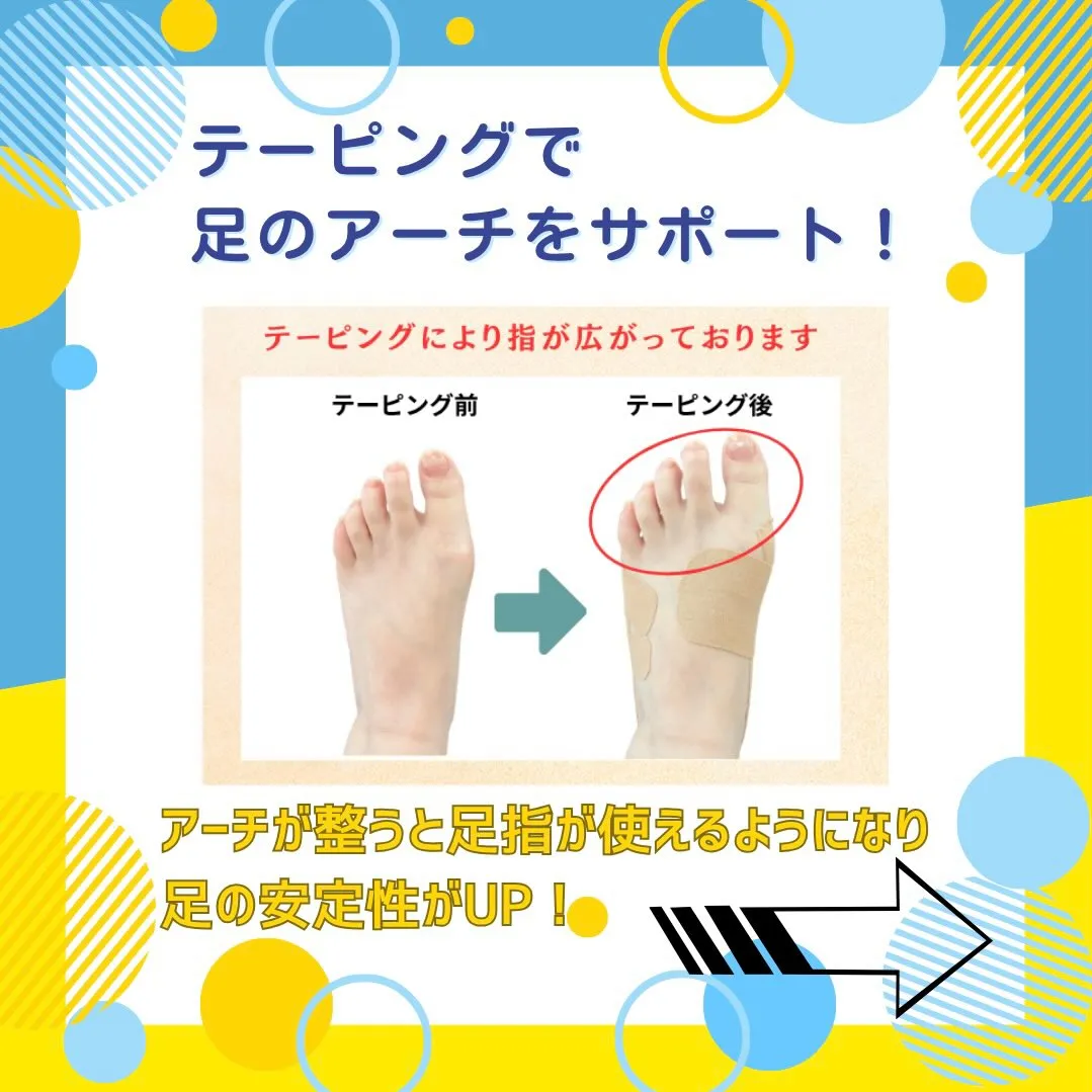 新メニュー🌟アーチサポートテーピング🦶🏻