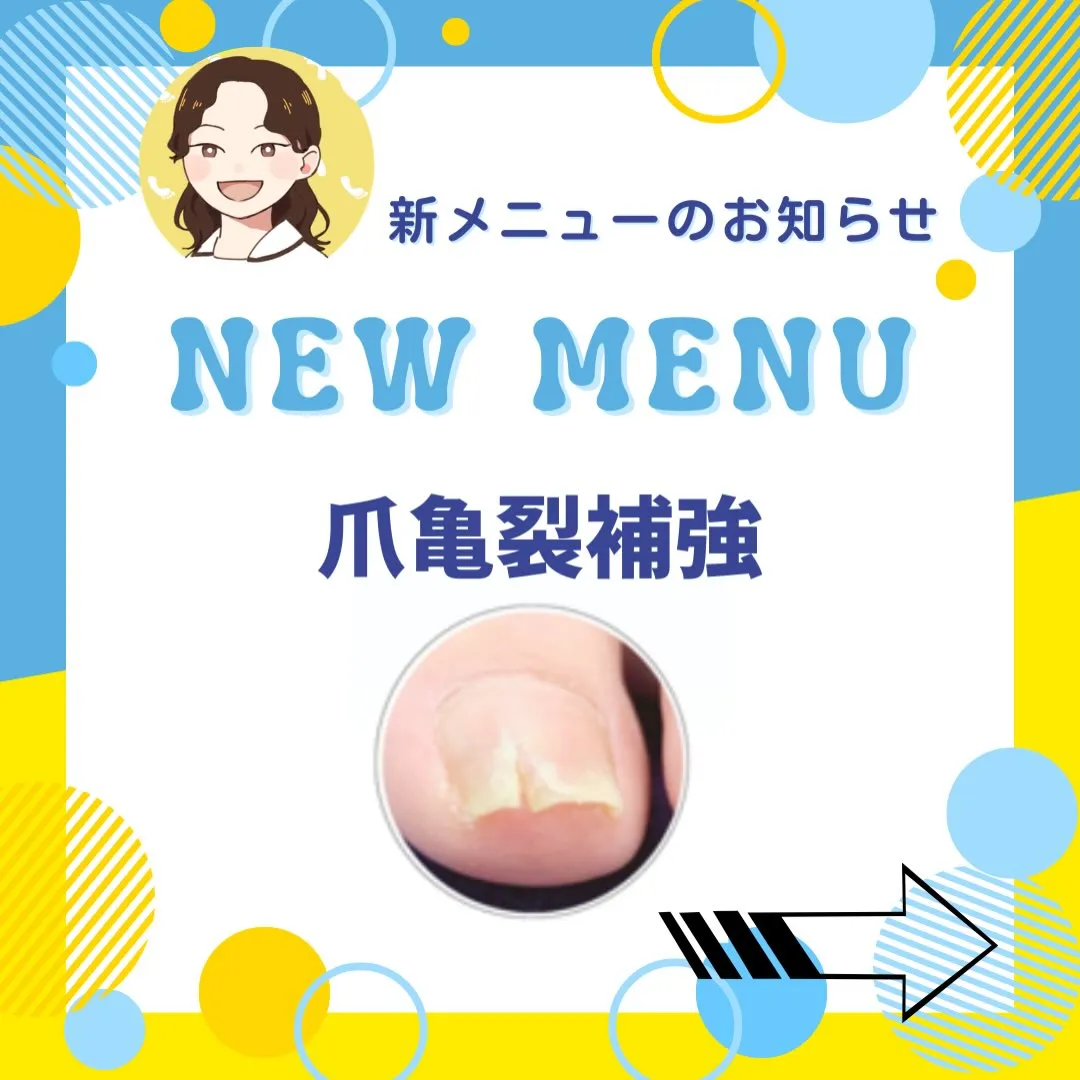 新メニュー🌟爪亀裂補強ケア